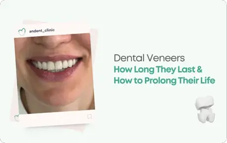 Dental Veneers Albania