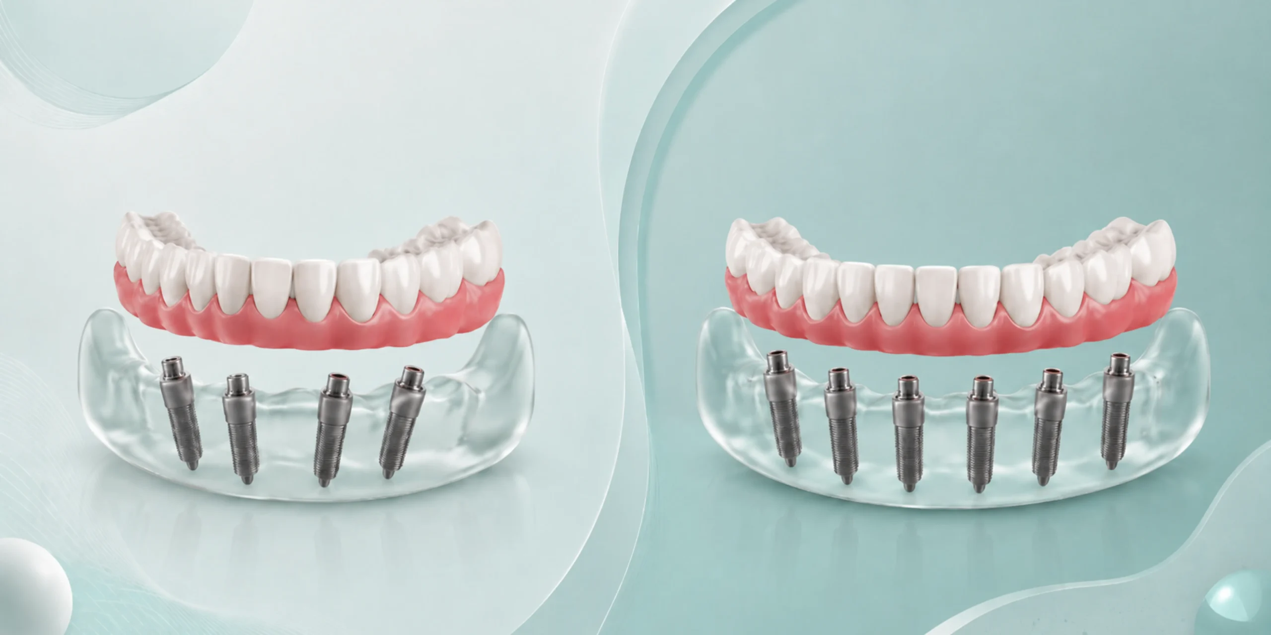 Dental bridges in Albania at Andent Tirana